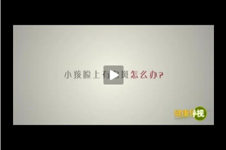 小孩脸上有白斑怎么办?